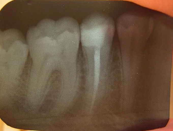 Radiologi Mulut dan Maksilofasial