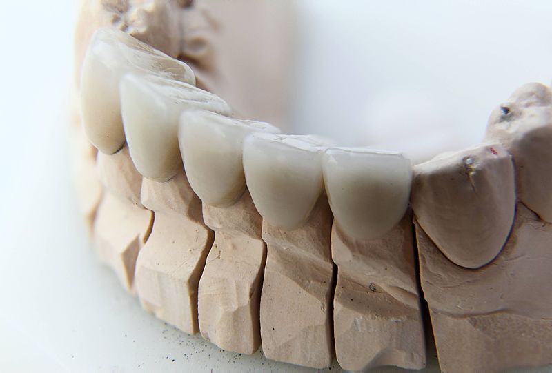 Gigi Pediatric atau spesialis gigi anak